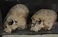 Deformed skulls, Afrasiab, Samarkand, Sogdia,  600–800 AD.