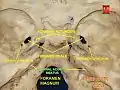 Internal acoustic meatus