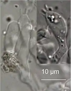 Basidium