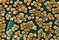 Colorized micrograph: sphere-shaped bacteria clustered in grape-like bunches.