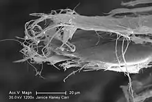 Scanning electron microscopy of white asbesto with needle-like shape fibre