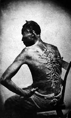 Image 9Slavery in the United StatesPhoto credit: McPherson and OliverScars of a whipped slave named Peter, photo taken at Baton Rouge, Louisiana, 1863. In his own words, "Overseer Artayou Carrier whipped me. I was two months in bed sore from the whipping. My master come after I was whipped; he discharged the overseer." The slave pictured here escaped from a plantation in Mississippi, made his way to Union forces, and joined the U.S. Army at the Union garrison located at Baton Rouge.Slavery in the United States began soon after the English colonists first settled in North America. From about the 1640s until 1865, people of African descent were legally enslaved within the boundaries of the present U.S. mostly by whites, but also by a comparatively tiny number of American Indians and free blacks. By 1860, the slave population in the U.S. had grown to 4 million.More featured pictures