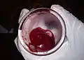 Blood drawn by wet cupping