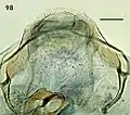 Female terminal abdominal segment