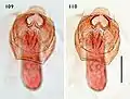 Male genitalia