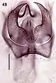 Male genitalia