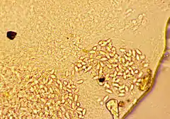 Cnidocysts