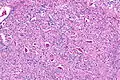 Micrograph showing the hypoglossal nucleus. H&E-LFB stain.