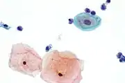 Very high magnification view