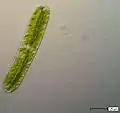 Netrium oblongum.&nbsp; A saccoderm "desmid"