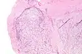 Low magnification