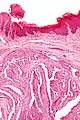 Intermediate magnification