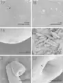 SEM of mature specimens of Echinorhynchus baeri