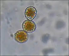 Uredospores