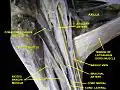 Deep dissection; anterior view