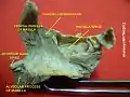 Right maxilla. Anterior nasal spine labeled at center left.
