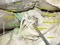 Right gastric artery