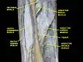 Muscles of Thigh. Anterior views.