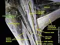 Coracobrachialis muscle (shown in green text)
