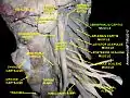 Semispinalis capitis muscle