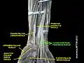 Flexor digitorum profundus muscle