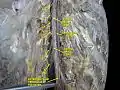 Lumbar spinal nerves.Deep dissection. Posterior view.