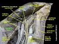 Pectineus muscle