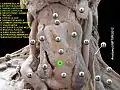 Cricoid cartilage