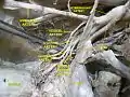 Umbilical artery. Deep dissection. Anterior view.