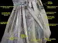 First metacarpal bone. Deep dissection.