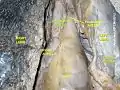 Ascending aorta