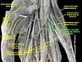 Superficial palmar arterial and venous arche