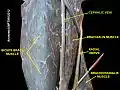 Cephalic vein