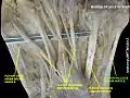 Flexor hallucis brevis muscle