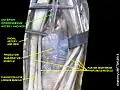 anterior  interosseous artery and nerve