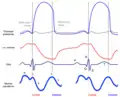 Wiggers with jugular venous waveform