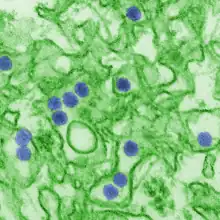 Electron micrograph of "Zika virus". Virus particles (colored purple) are 40 nm in diameter, with an outer envelope and a dense inner core.