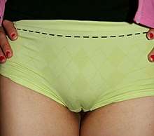 Color photograph of a camel toe